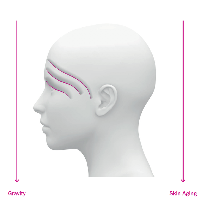 DISCONTINUED -Labo Eyelid Lifting Grade 3 - Set | Fillerina