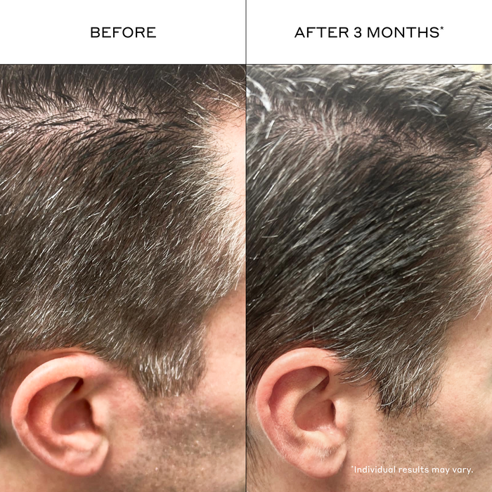 Zenagen Eclipse Shampoo before and after image showing healthier-looking hair with enhanced shine, improved vibrancy, and reduced appearance of dullness.