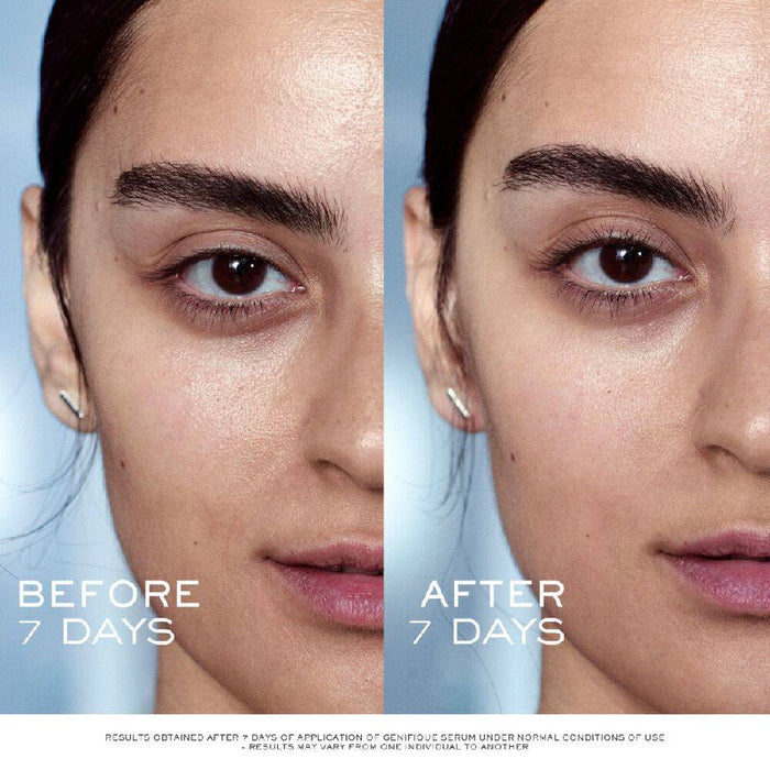 Lancome